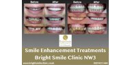 Transforming Your Smile: The Art of Smile Makeovers in Dentistry - London NW3