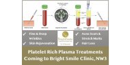 Platelet Rich Plasma Treatments coming to Bright Smile Clinic, NW3