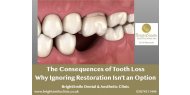 The Consequences of Tooth Loss: Why Ignoring Restoration Isn't an Option