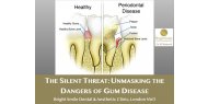 The Silent Threat: Unmasking the Dangers of Gum Disease