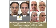 Unlocking Natural Beauty: Exploring Holistic Facial Harmonization with Injectables